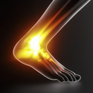 https://www.paininstituteindia.com/wp-content/uploads/2015/11/anklepain-320x320.jpg